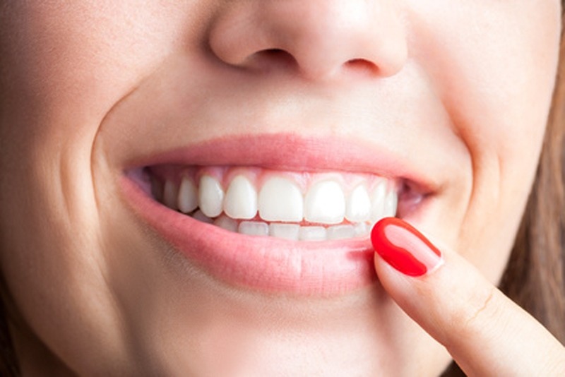 Enhance Your Smile with Porcelain Crowns