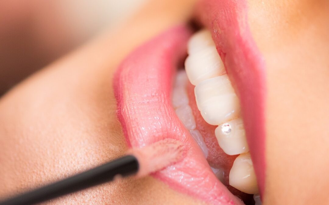 Composite fillings in Grande Prairie Alberta