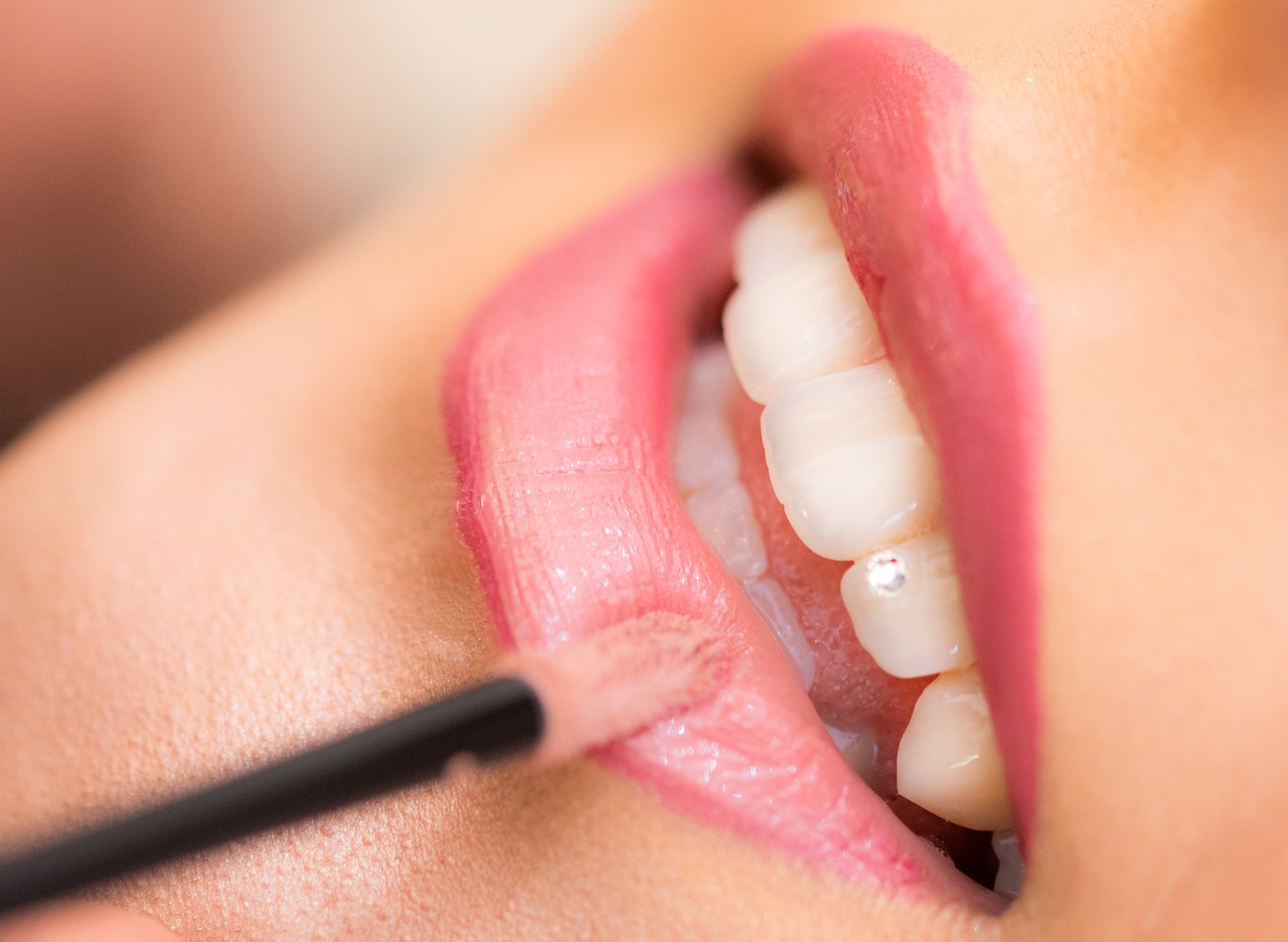 dental fillings - Grande Prairie Dentist - Boisson Dental Group dental fillings