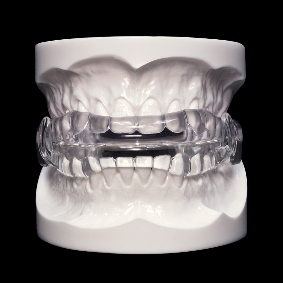 MicrO2_Front