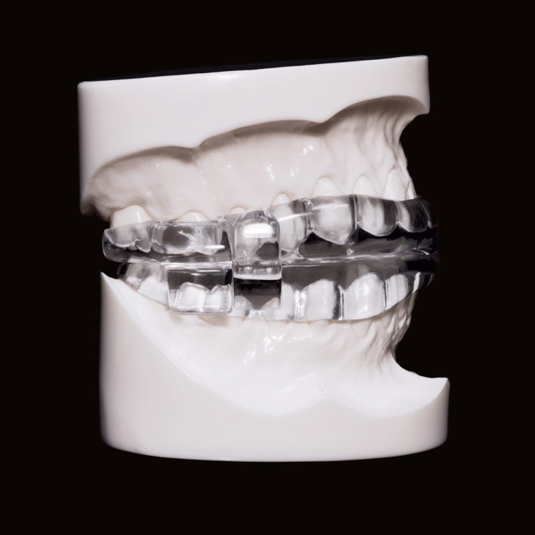 MicrO2_Profile-e1492103509210-768x768