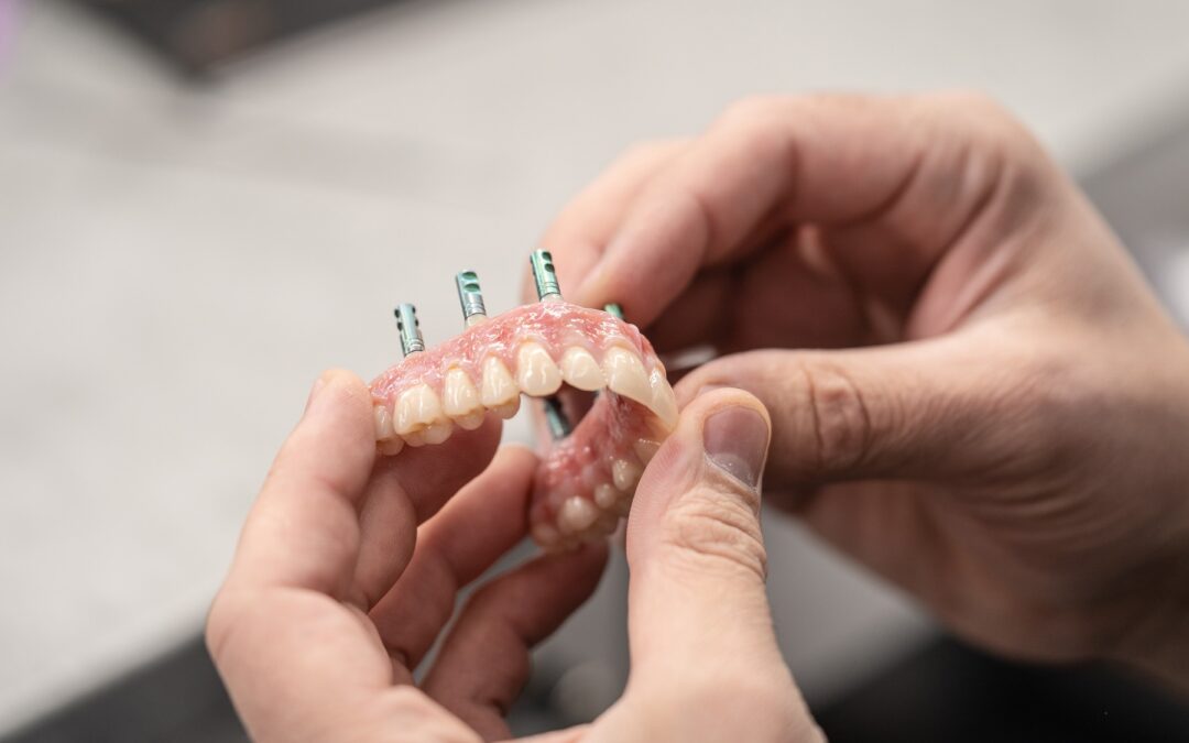 The Benefits of Dental Implants