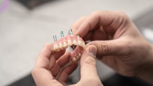 boisson-blog-feb-11-all-on-4-implants-2000px-300x169 All,On,4,Dentures,,Upper,And,Lower,Teeth